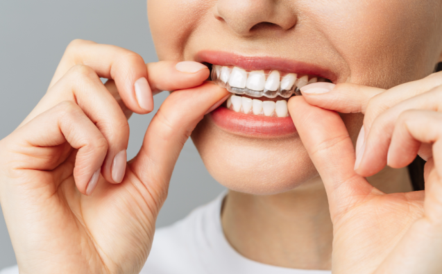 Clear aligner bite correction