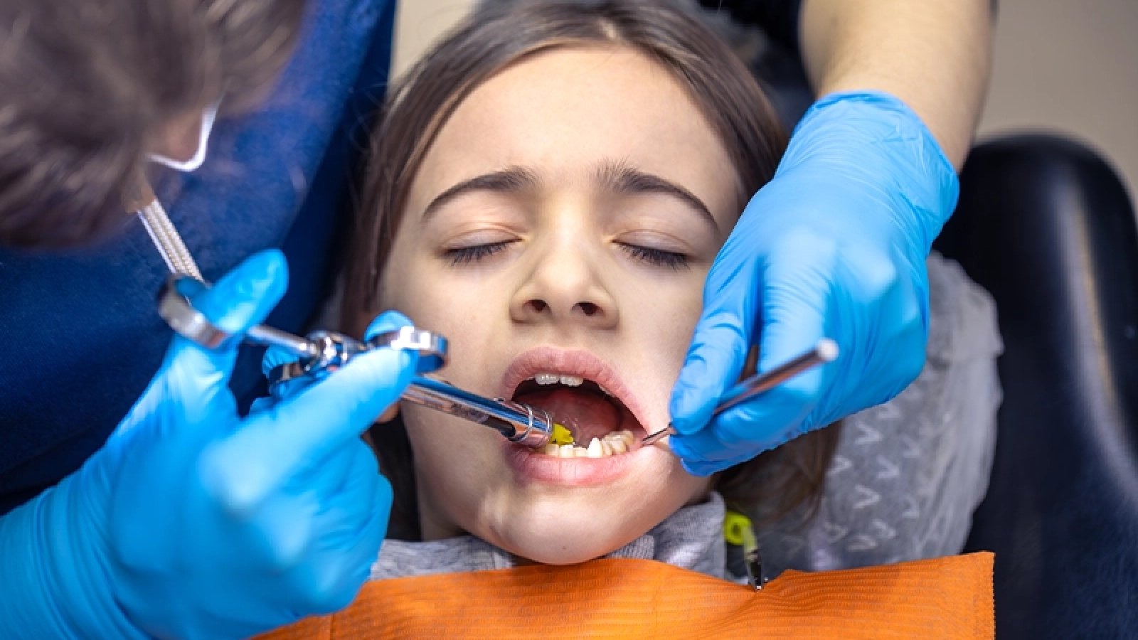 Common Dental Problems in Children